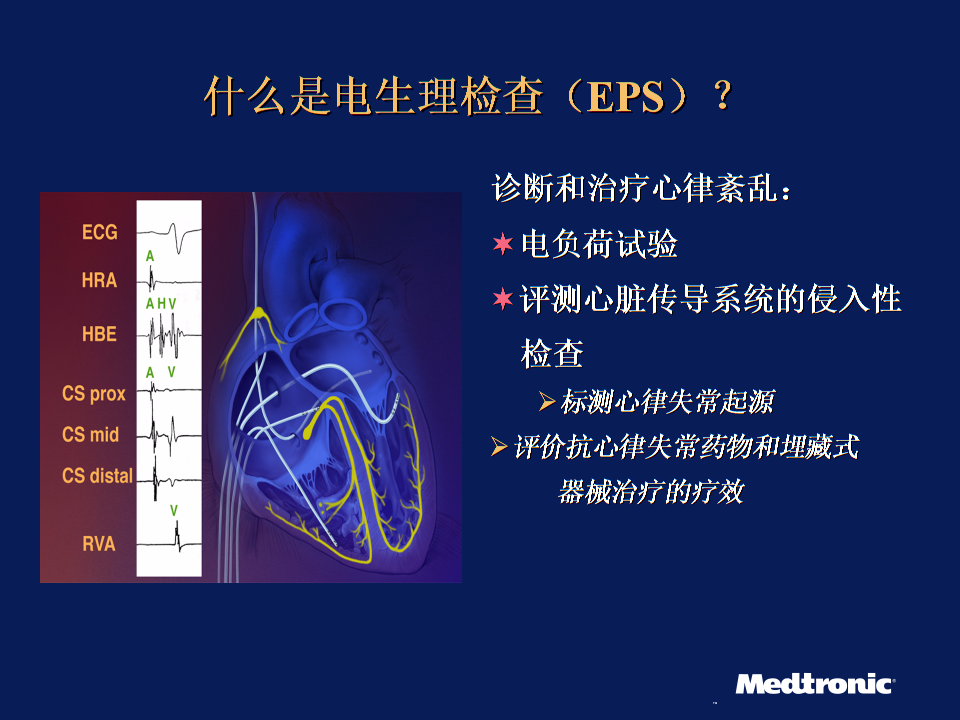 阵发性房性心动_阵发性室上性心动过速治疗_阵发性房动心动过速