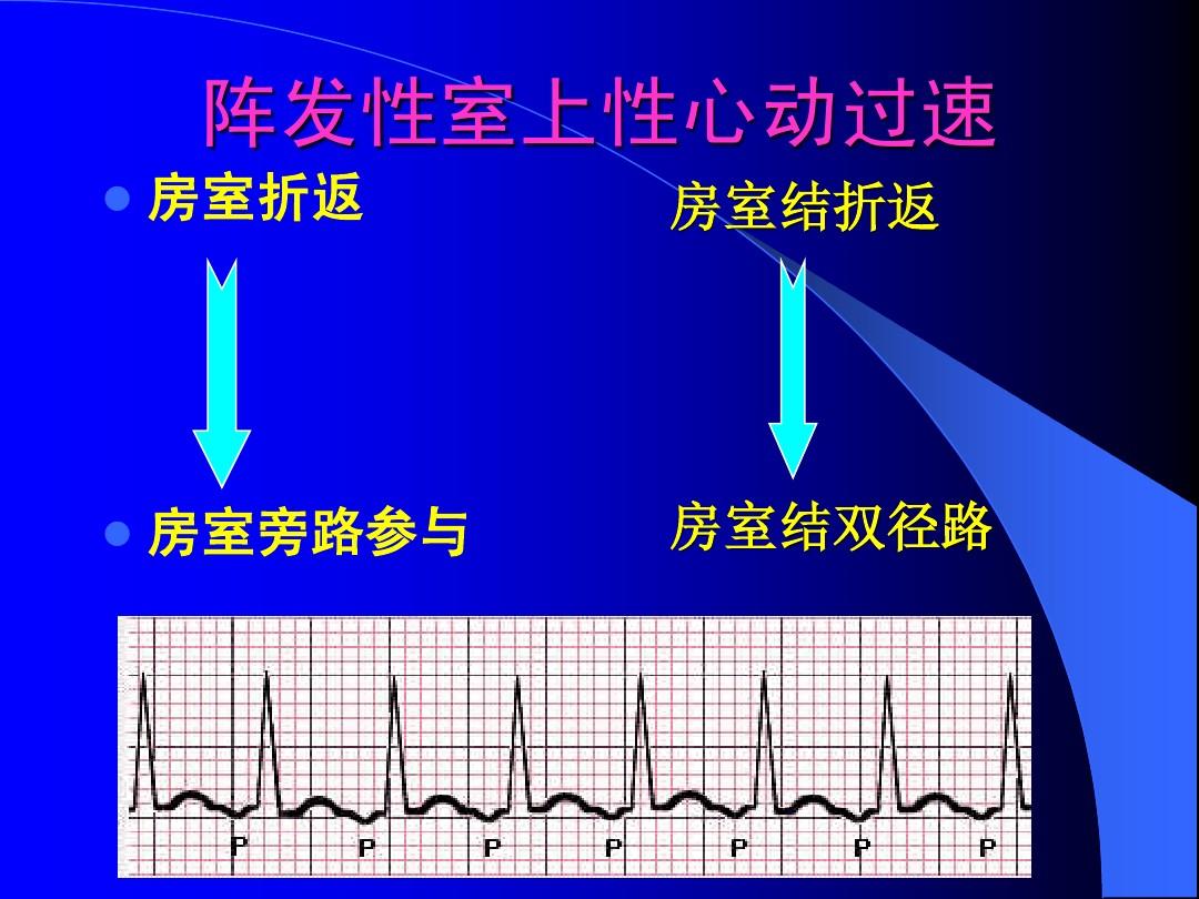 阵发心房扑动_阵发性室上性心动过扑_阵发性心房扑动吃什么药