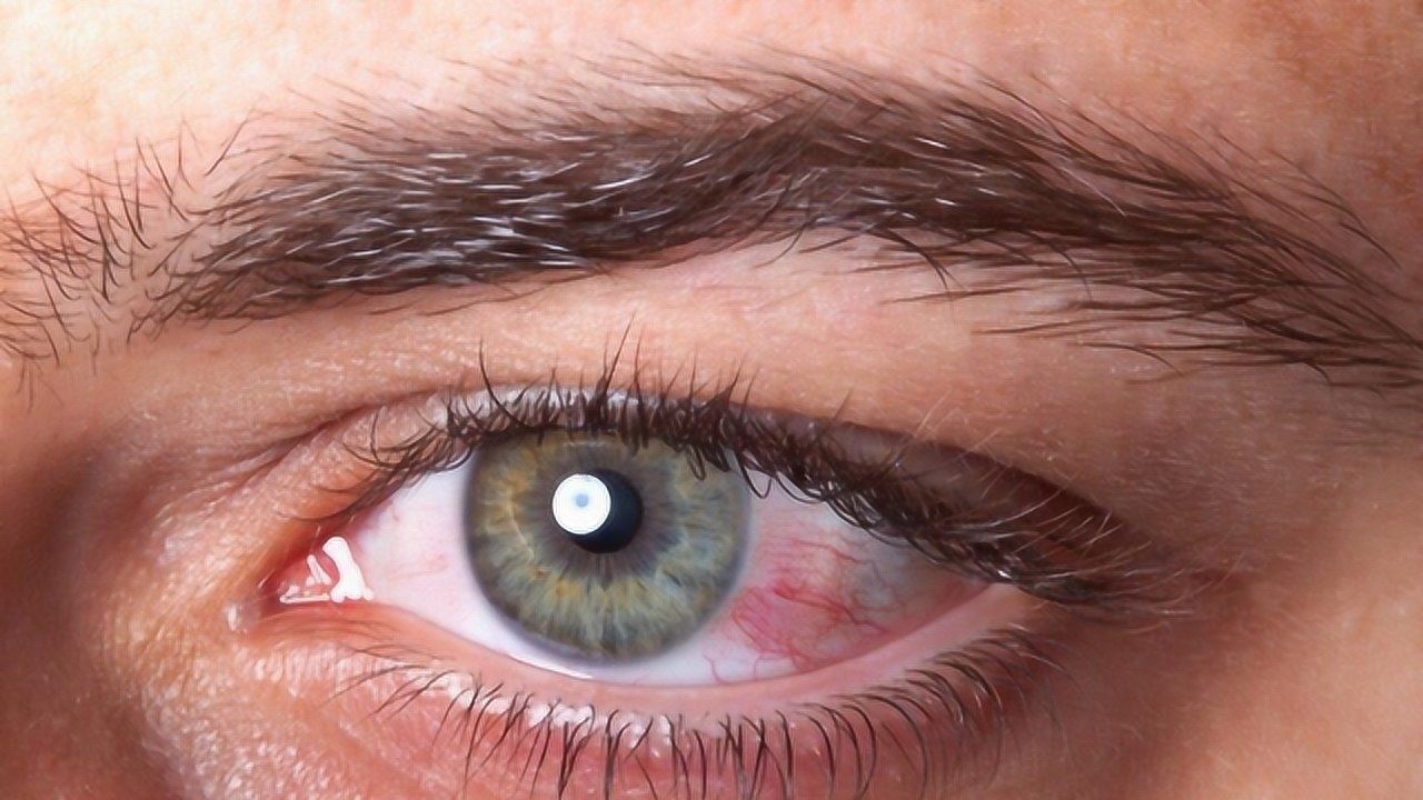 打手机游戏近视_近视了打游戏要带眼镜吗_近视对打游戏有影响吗